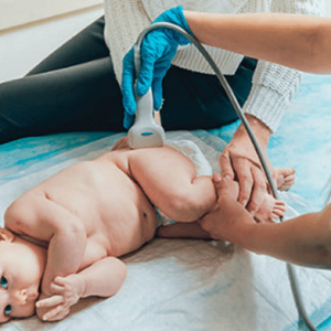 ecografia dell'anca neonatale - esecuzione dell'ecografia su neonato