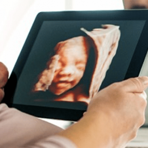 ecografia in gravidanza tridimensionale - mamma guarda ecografia tridimensionale