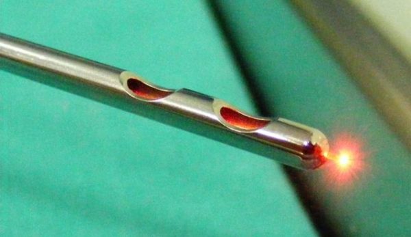 laserlipolisi liposuzione laser - strumento per effettuare il trattamento