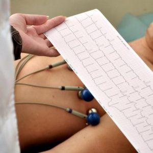 elettrocardiogramma a riposo - esecuzione esame su paziente