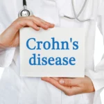 malattia-di-crohn